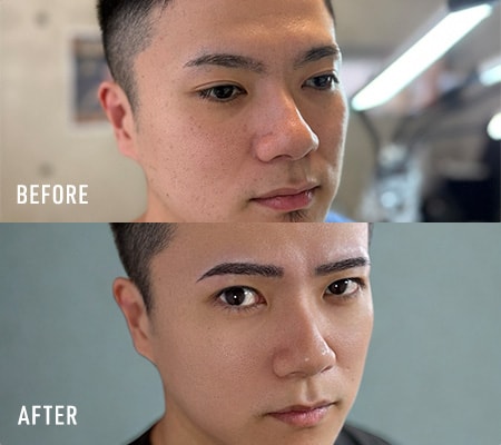 施術例 Before After
