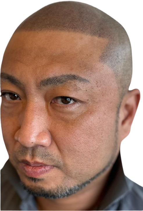 スカルプインク施術後