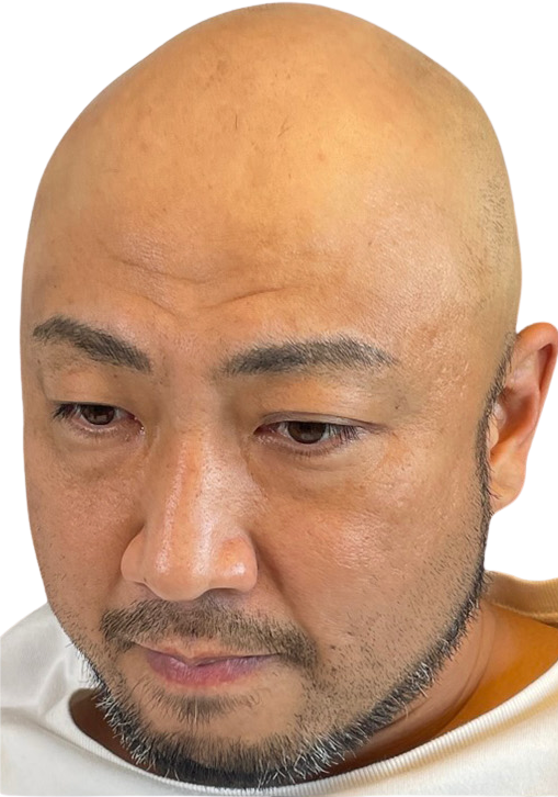 施術前