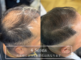 施術例